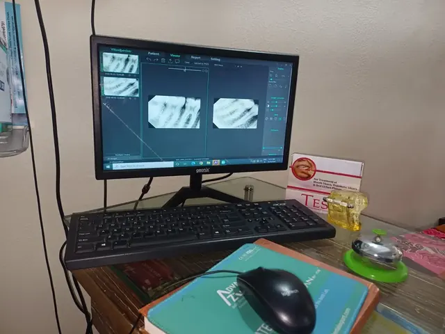 Computer screen showing digital dental X-rays
